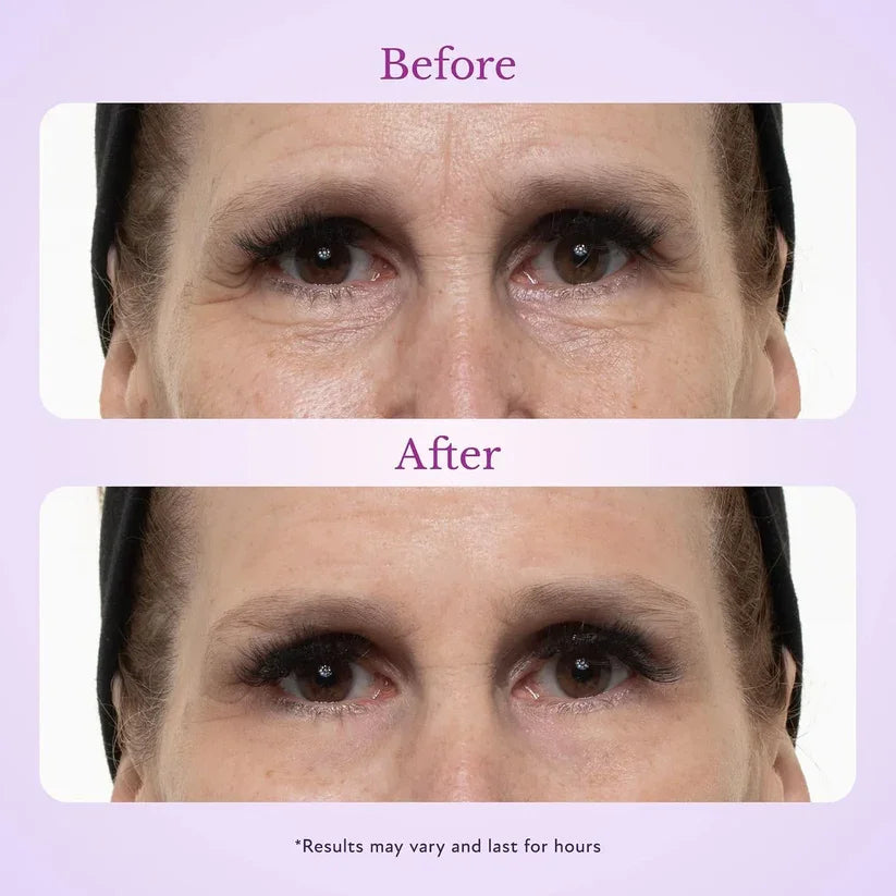 TopSpire 60 Second Effects Tinted Firming Gel - Under Eye Cream For Puffiness And Bags Under Eyes