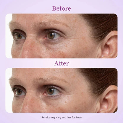 TopSpire 60 Second Effects Tinted Firming Gel - Under Eye Cream For Puffiness And Bags Under Eyes