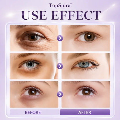 TopSpire 60 Second Effects Tinted Firming Gel - Under Eye Cream For Puffiness And Bags Under Eyes