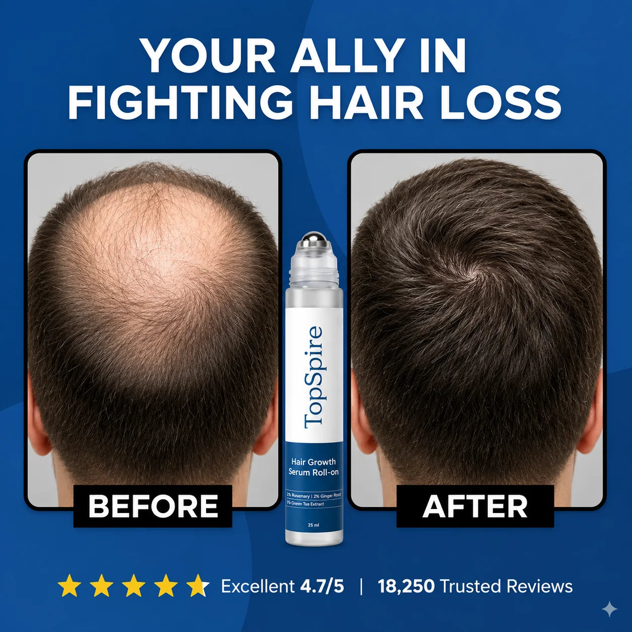 TopSpire Hair Growth Roll on Serum
