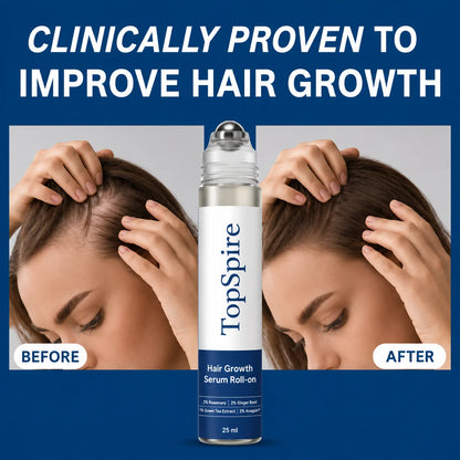 TopSpire Hair Growth Roll on Serum
