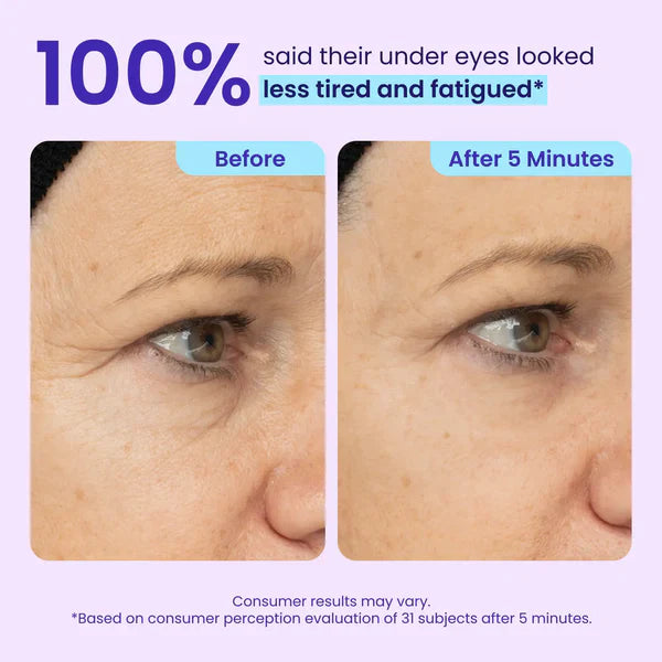 Softryn Eye Bag Instant Eraser, Tightens, Firms, & Blurs Wrinkles
