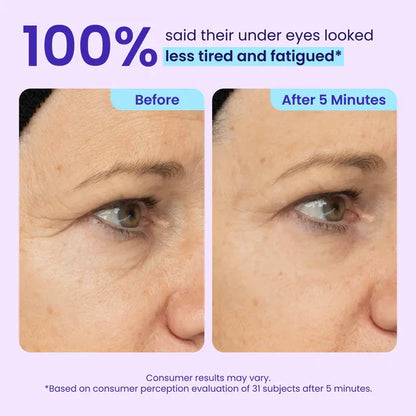 Softryn Eye Bag Instant Eraser, Tightens, Firms, & Blurs Wrinkles