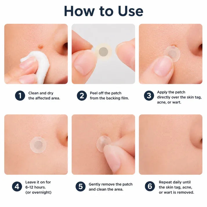 ✨Softryn®2-in-1 Microneedle & Hydrocolloid Patch🍀| Removes Raised Moles, Acne, Flat Warts & Skin Tags | Helps Improve Wrinkles, Scars & Blemishes | Invisible Patches for Face & Body