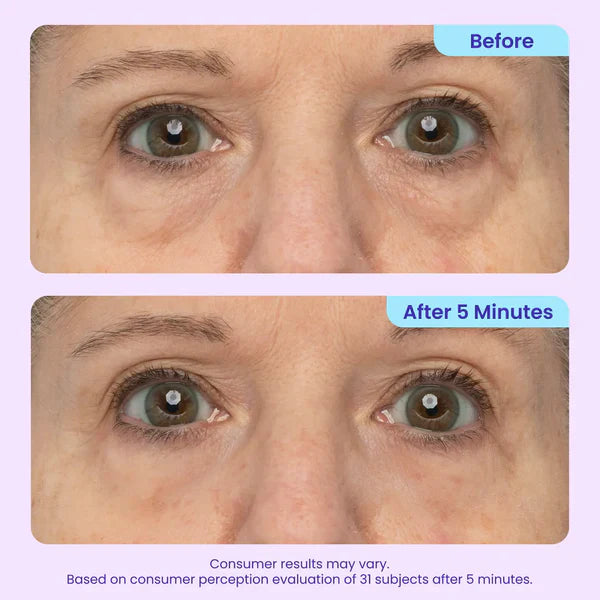 Softryn Eye Bag Instant Eraser, Tightens, Firms, & Blurs Wrinkles