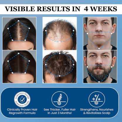 TopSpire Hair Growth Roll on Serum