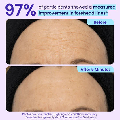 Softryn Eye Bag Instant Eraser, Tightens, Firms, & Blurs Wrinkles