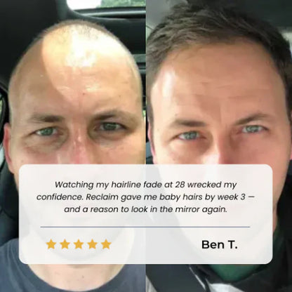 TopSpire Hair Growth Roll on Serum
