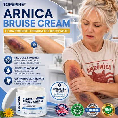 💥75K+ SOLD💕 TOPSPIRE® Arnica Bruise Cream - Repair Bruises & Strengthen Fragile Skin