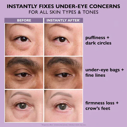 Softryn Eye Bag Instant Eraser, Tightens, Firms, & Blurs Wrinkles