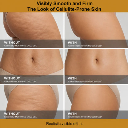 Softryn™ Cryo ThermoFirming Gold Gel — Look Smoother, Firmer & More Confident in Your Body — in Just 15 Days