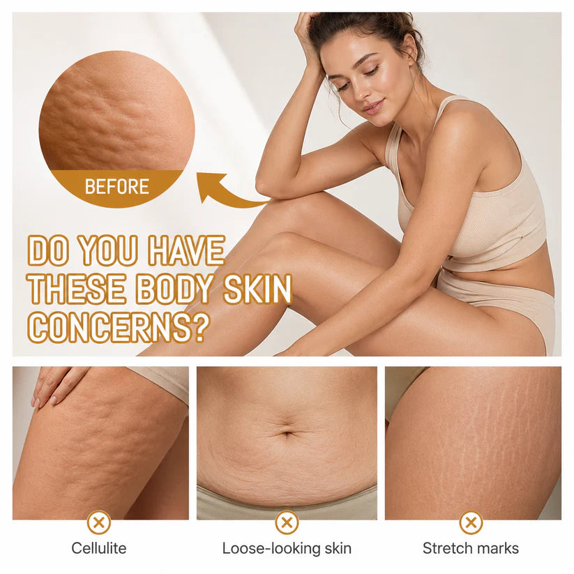 Softryn™ Cryo ThermoFirming Gold Gel — Look Smoother, Firmer & More Confident in Your Body — in Just 15 Days