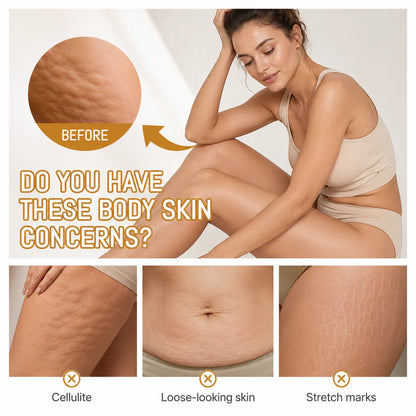Softryn™ Cryo ThermoFirming Gold Gel — Look Smoother, Firmer & More Confident in Your Body — in Just 15 Days