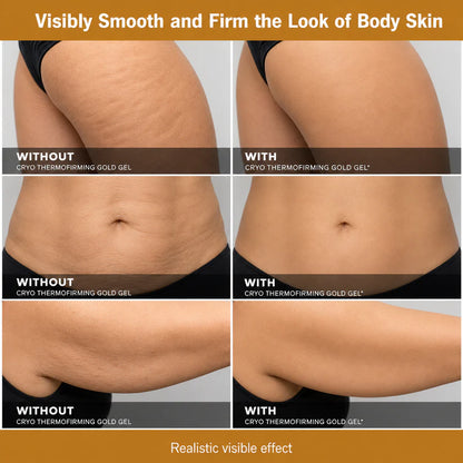 Softryn™ Cryo ThermoFirming Gold Gel — Look Smoother, Firmer & More Confident in Your Body — in Just 15 Days